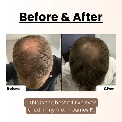 Batana Oil For Hair Growth