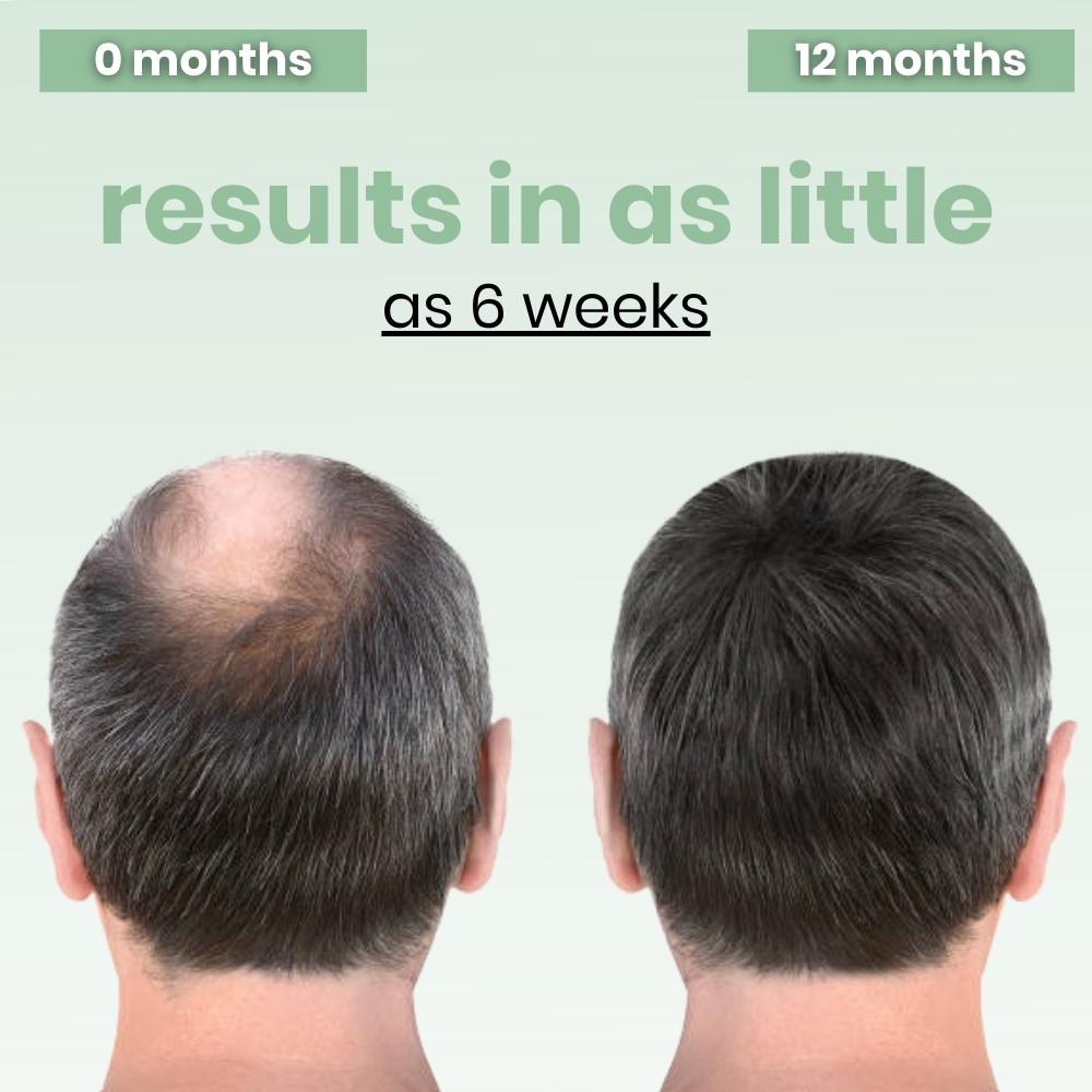 Hair Revive Pro™