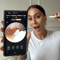 Orvita™ Pro - Smart öronrengöring med HD-kamera