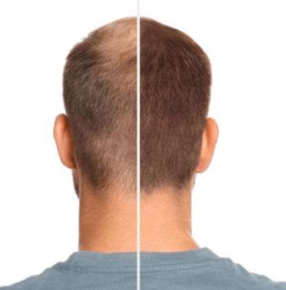 Nova™ Hairfillup natürliches Aussehen und wasserabweisender Schutz