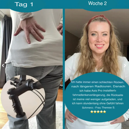 Axis Comfort - Fahrradlenker-Verlängerung zur Schmerzlinderung