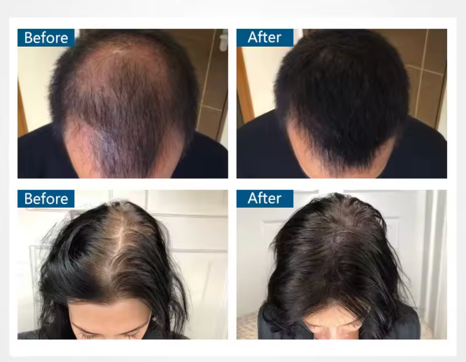 Toppik Hair Thickening Spray - För fylligare och friskare hår på ett ögonblick!