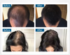 Toppik Hair Thickening Spray - För fylligare och friskare hår på ett ögonblick!