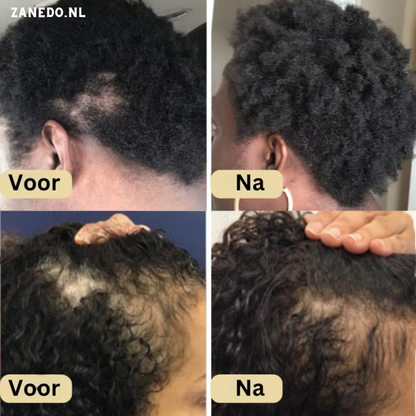 Natuurlijke Haargroei Olie - Veganic Zanedo