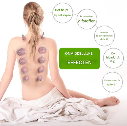 Set van 12 Massagecups - Verlicht spier en gewrichtspijn