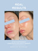LumiHuid LED Masker